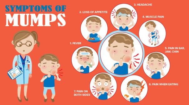 mumps-infographic-VCH-1